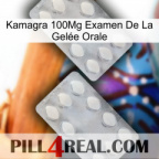 Kamagra 100Mg Examen De La Gelée Orale 17